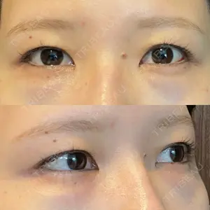 藤・ナチュレ美容クリニック 藤・ナチュレ美容クリニック 銀座院口コミ