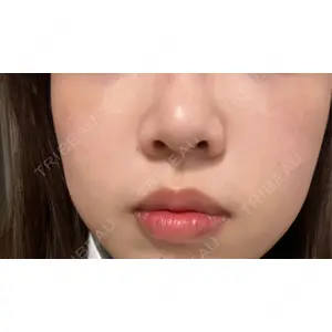 口コミ