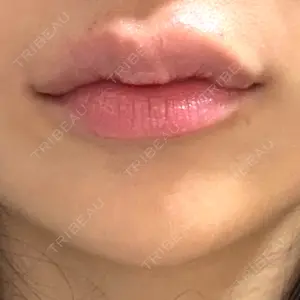 口コミ