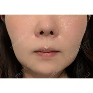 口コミ