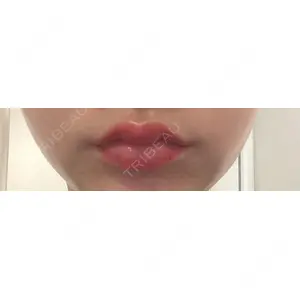 口コミ