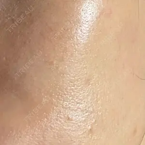 美容皮膚科 デュークリニック口コミ