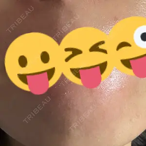 美容皮膚科 デュークリニック口コミ