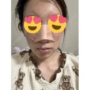 口コミ