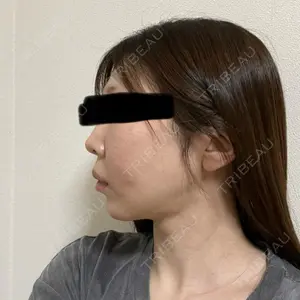口コミ