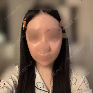 セギム美容整形外科口コミ