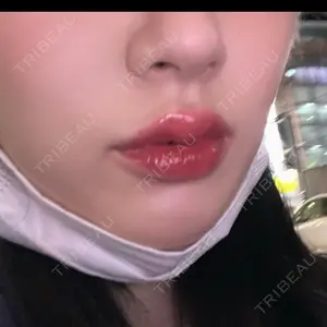 ルラ美容クリニック ルラ美容クリニック 大阪本院口コミ