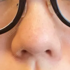 B-LINE CLINIC B-LINE CLINIC 池袋院口コミ