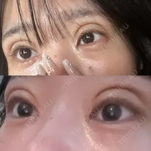 東京シンデレラ美容外科 東京シンデレラ美容外科 池袋院口コミ