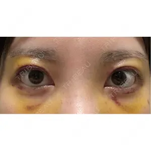 PRO CLINIC プロクリニック 銀座院口コミ
