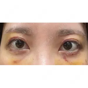 PRO CLINIC プロクリニック 銀座院口コミ