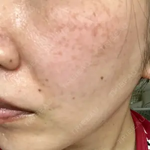 ルラ美容クリニック ルラ美容クリニック 大宮院口コミ