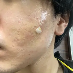 PRISM Beauty Clinic口コミ