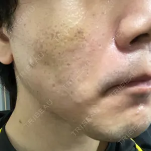 PRISM Beauty Clinic口コミ