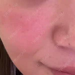 NARU Beauty Clinic NARU Beauty Clinic 【ナルクリ】 水戸院口コミ