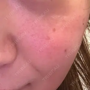 NARU Beauty Clinic NARU Beauty Clinic 【ナルクリ】 水戸院口コミ