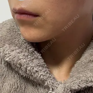 TCB東京中央美容外科 TCB東京中央美容外科 上野院口コミ