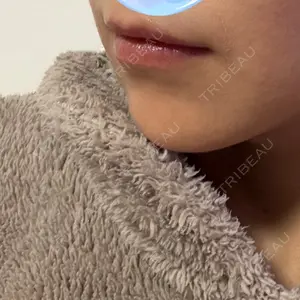TCB東京中央美容外科 TCB東京中央美容外科 上野院口コミ