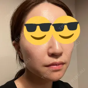 HINATA クリニック口コミ