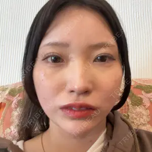 東京シンデレラ美容外科 東京シンデレラ美容外科 池袋院口コミ