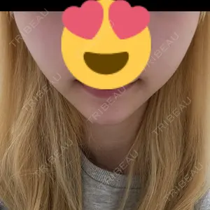 フォンタナクリニック天神口コミ