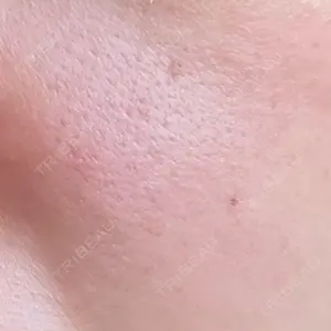 NARU Beauty Clinic NARU Beauty Clinic 【ナルクリ】 水戸院口コミ