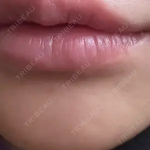 NARU Beauty Clinic NARU Beauty Clinic 【ナルクリ】 水戸院口コミ