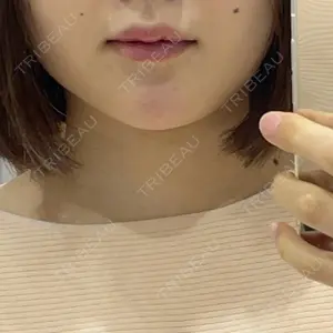 フォンタナクリニック天神口コミ