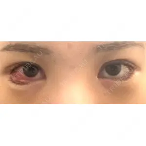 BIANCA CLINIC BIANCA銀座口コミ