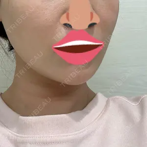 口コミ