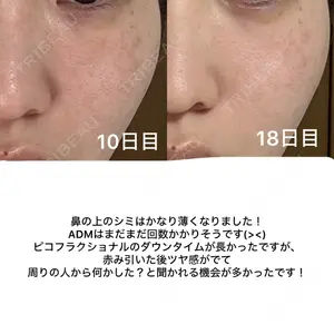 口コミ