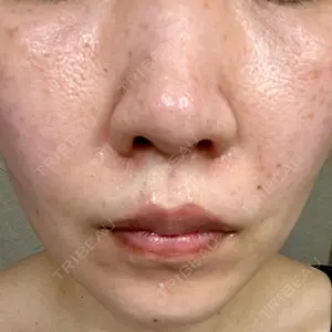 ルラ美容クリニック ルラ美容クリニック 大宮院口コミ