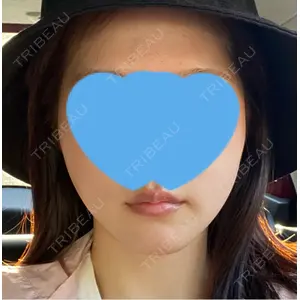 DMTC美容皮膚科 DMTC美容皮膚科 日本橋院口コミ