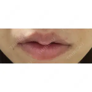 口コミ
