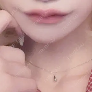 PRO CLINIC プロクリニック 銀座院口コミ
