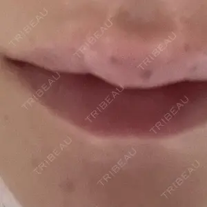 フォンタナクリニック天神口コミ