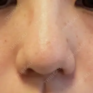 B-LINE CLINIC B-LINE CLINIC 池袋院口コミ