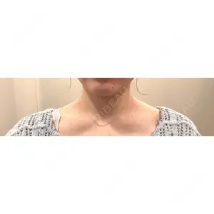 口コミ
