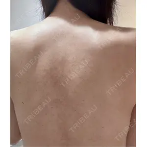 ブリリアスキンクリニック口コミ