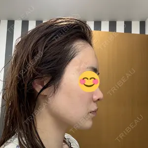 HAAB×DREAM BEAUTY CLINIC 大阪梅田院の