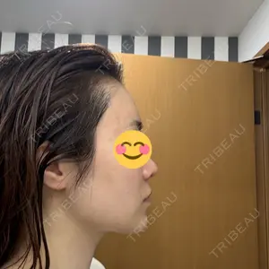 HAAB×DREAM BEAUTY CLINIC 大阪梅田院の