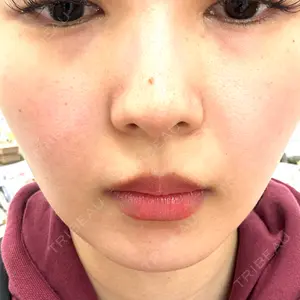 メディアージュクリニック メディアージュクリニック 青山院口コミ