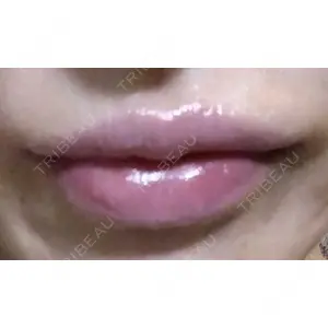 口コミ