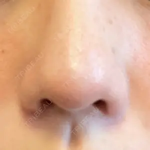 B-LINE CLINIC 池袋院口コミ