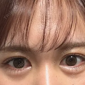 吉祥寺アイビークリニック口コミ