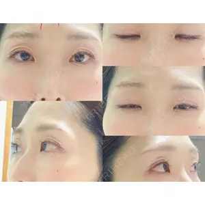 口コミ