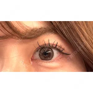 口コミ