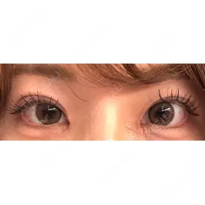 口コミ