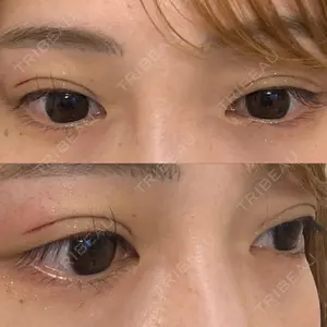 口コミ