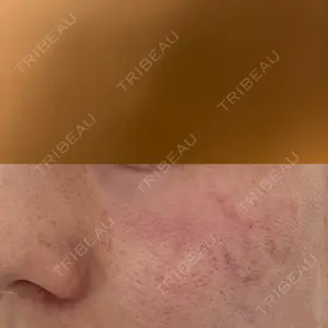 ライズワン美容皮膚科クリニック口コミ